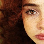 Kuinka päästä eroon frecklesistä? Kuinka päästä eroon frecklesistä?